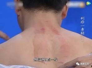 背部刮痧视频